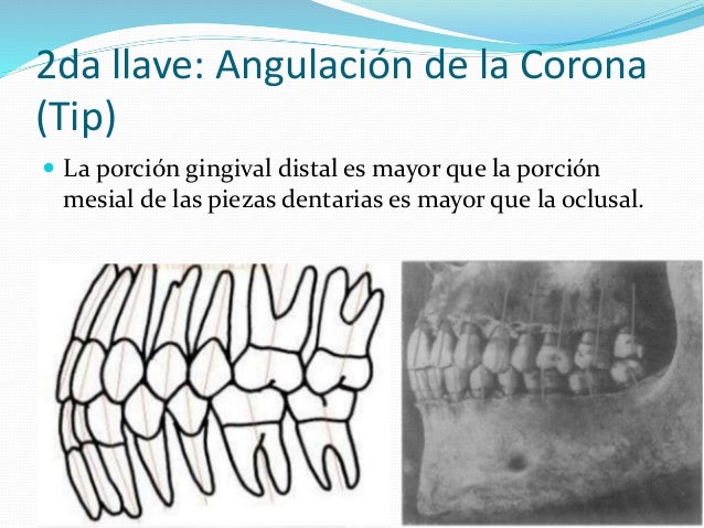 6 llaves de la oclusion andrews